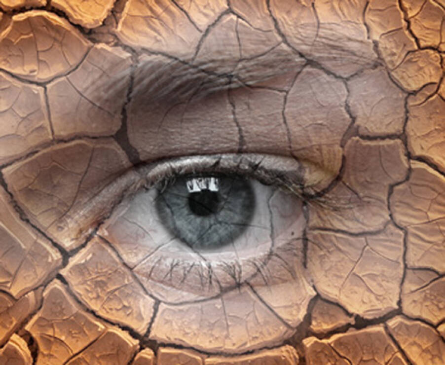 Akių sausumas – dažna liga
