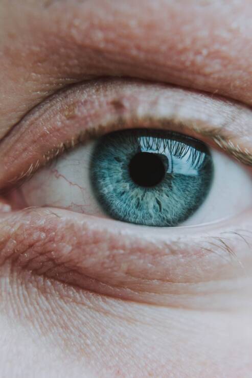 Glaukoma – akių liga, kurios padariniai negrįžtami: gydytoja patarė, kaip jai užkirsti kelią laiku