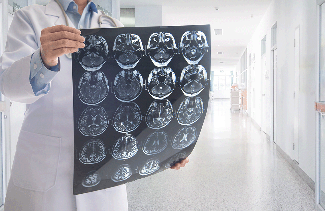 Neurochirurgas išvardijo priežastis, lemiančias hidrocefaliją