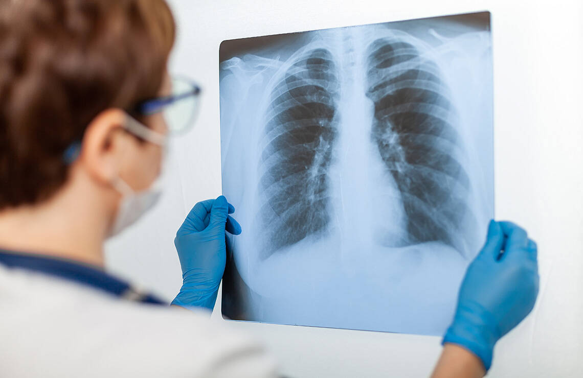 Primename, kad „Kardiolitos klinikose“ atliekame rentgeno tyrimus