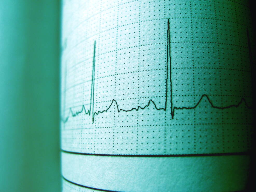 Sutrikusiam širdies ritmui atstatyti – gydymas vaistais ir elektroimpulso terapija